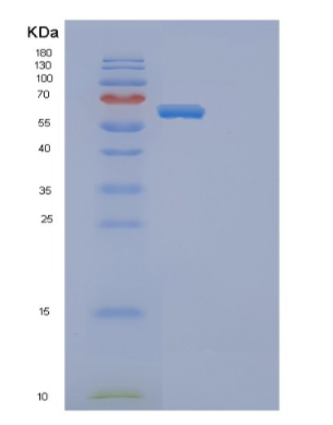 Recombinant Mouse Ephb4 Protein,Recombinant Human TAU Protein