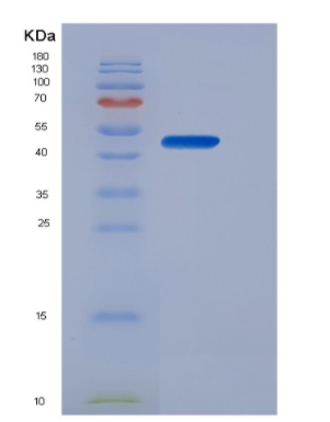 Recombinant Erythropoietin (EPO),Recombinant Erythropoietin (EPO)