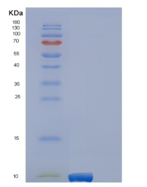 Recombinant Human EREG Protein,Recombinant Human EREG Protein