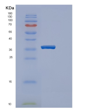 Recombinant Human ERGIC3 Protein,Recombinant Human ERGIC3 Protein