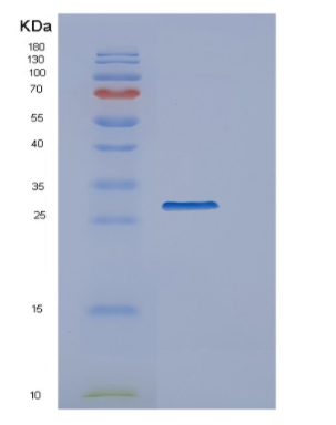 Recombinant Human ERP27 Protein,Recombinant Human ERP27 Protein