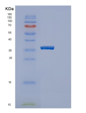 Recombinant Human Estrogen Sulfotransferase Protein,Recombinant Human Estrogen Sulfotransferase Protein