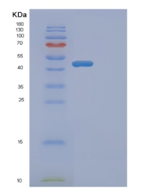 Recombinant Human ETNK2 Protein,Recombinant Human ETNK2 Protein