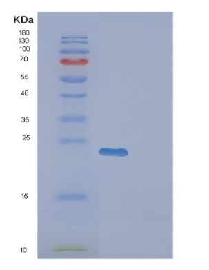 Recombinant Human EXOSC1 Protein,Recombinant Human EXOSC1 Protein