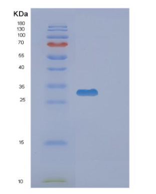 Recombinant Human EXOSC3 Protein,Recombinant Human EXOSC3 Protein