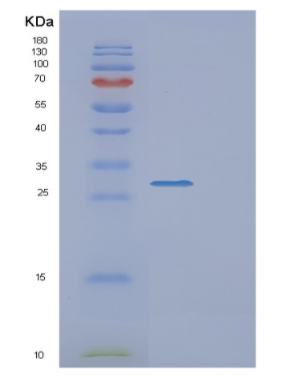 Recombinant Human EXOSC4 Protein,Recombinant Human EXOSC4 Protein