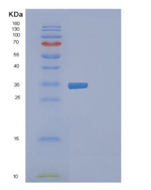 Recombinant Human EXOSC7 Protein,Recombinant Human EXOSC7 Protein