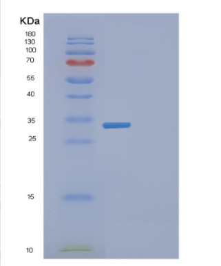 Recombinant Human EXOSC8 Protein,Recombinant Human EXOSC8 Protein