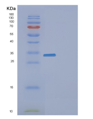 Recombinant Human F2 Protein,Recombinant Human F2 Protein