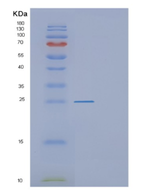 Recombinant Mouse F3 Protein,Recombinant Mouse F3 Protein