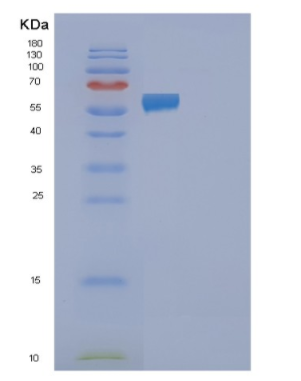 Recombinant Human FAAH2 Protein,Recombinant Human FAAH2 Protein