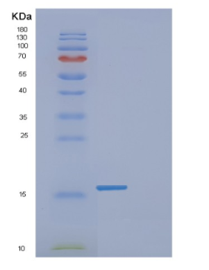 Recombinant Human FABP1 Protein,Recombinant Human FABP1 Protein