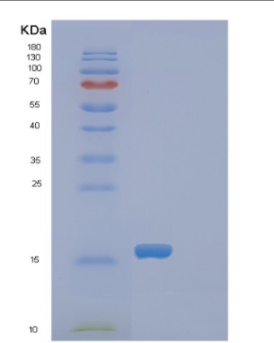 Recombinant Rat Fabp1 Protein,Recombinant Rat Fabp1 Protein