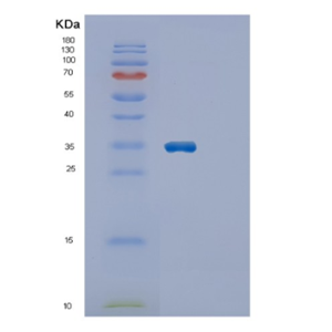 Recombinant Human ECHDC1 Protein