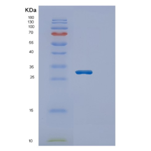 Recombinant Human ECHS1 Protein