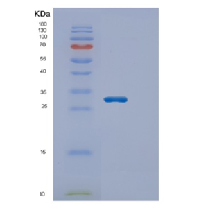 Recombinant Human ECHS1 Protein,Recombinant Human ECHS1 Protein