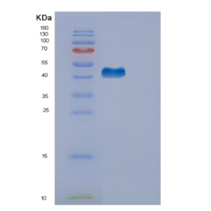 Recombinant Human EDA2R Protein