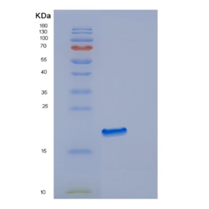 Recombinant Human EDN2 Protein,Recombinant Human EDN2 Protein