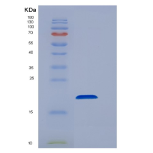 Recombinant Human EEF1E1 Protein,Recombinant Human EEF1E1 Protein