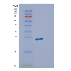 Recombinant Human ECSIT Protein