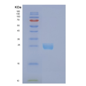 Recombinant Human EFNB1 Protein