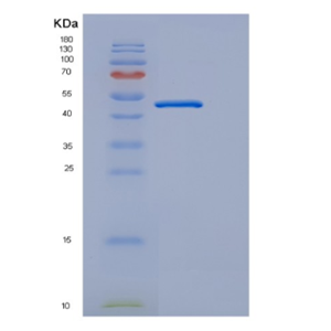 Recombinant Human EDAR Protein