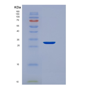 Recombinant Human EEF1D Protein