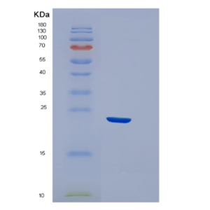 Recombinant Human EFNA3 Protein