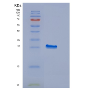 Recombinant Human EDN3 Protein,Recombinant Human EDN3 Protein
