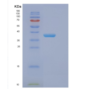 Recombinant Human EIF2S1 Protein