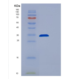 Recombinant Human EEF2 Protein,Recombinant Human EEF2 Protein