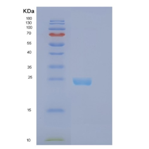 Recombinant Human EFNB2 Protein,Recombinant Human EFNB2 Protein