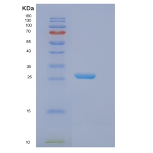 Recombinant Human EIF3K Protein,Recombinant Human EIF3K Protein