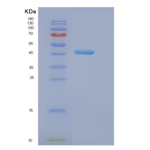 Recombinant Human EIF4A3 Protein