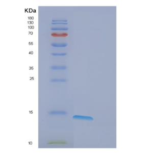 Recombinant Human eIF4E-BP1 Protein