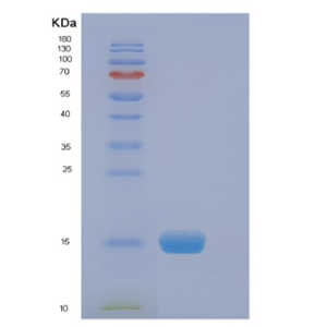 Recombinant Human EIF4EBP2 Protein,Recombinant Human EIF4EBP2 Protein