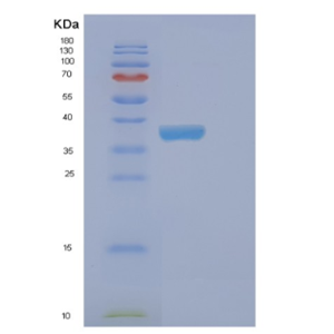 Recombinant Human EHF Protein