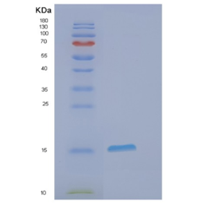 Recombinant Human EIF1 Protein,Recombinant Human EIF1 Protein