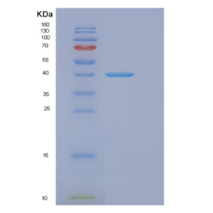 Recombinant Human EIF3F Protein