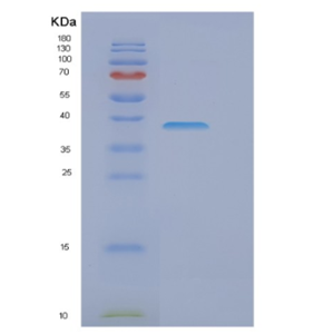 Recombinant Human EIF3I Protein,Recombinant Human EIF3I Protein