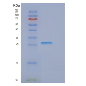 Recombinant Human EIF4E Protein,Recombinant Human EIF4E Protein