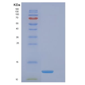 Recombinant Human EIF4EBP3 Protein,Recombinant Human EIF4EBP3 Protein