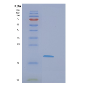 Recombinant Human EIF5A2 Protein,Recombinant Human EIF5A2 Protein