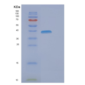 Recombinant Human ELAC1 Protein,Recombinant Human ELAC1 Protein