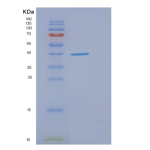 Recombinant Human ELAVL2 Protein,Recombinant Human ELAVL2 Protein