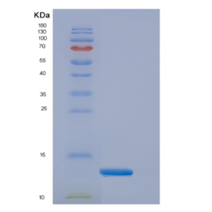 Recombinant Human Elongin B Protein,Recombinant Human Elongin B Protein