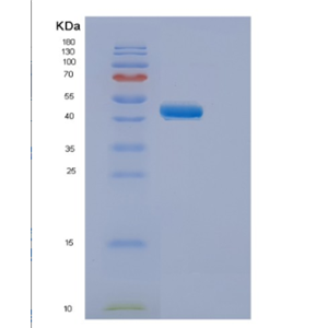 Recombinant Human ELP4 Protein