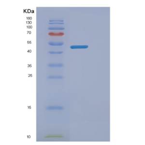 Recombinant Human ENTPD6 Protein