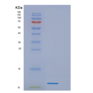 Recombinant Human Mycobacterium tuberculosis ESAT6 Protein,Recombinant Human Mycobacterium tuberculosis ESAT6 Protein