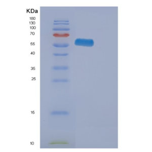 Recombinant Human EPHA2 Protein,Recombinant Human EPHA2 Protein